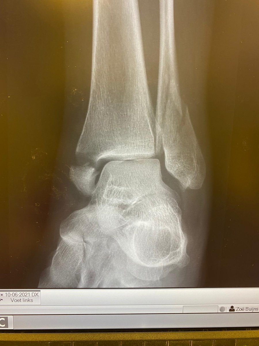 BPlaatje's tweet photo. " Tis heus geen verdienmodel hoor.".  Ik wil niet generaliseren maar lijkt het soms of bijna iedere uitzendbaas/huisbaas een boef is ? @wkoolmees het stopt niet vanzelf. https://t.co/lLatY5vvul