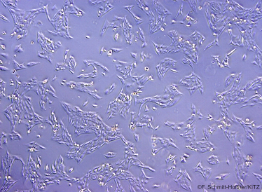 KiTZ_HD's tweet photo. #KiTZScience🔬 Wissenschaftler des #KiTZ_HD, des @DKFZ und der @UniHeidelberg haben einen wichtigen Schlüssel zur aggressiven Ausbreitung von #Neuroblastomen gefunden🧬: FOXR2 heißt das Protein, das auch Rückschlüsse auf den Krankheitsverlauf bei diesen häufigen... https://t.co/muUDC61y6t