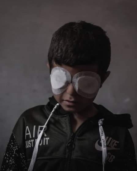 Did you see this little guy?
His name is Mohamed Chaabane and he lost his sight during the last bombing on Gaza.

#FreePalestine
#Save_Palestinian_48
#savesheikhjarrah
#SaveSilwan #savelifta