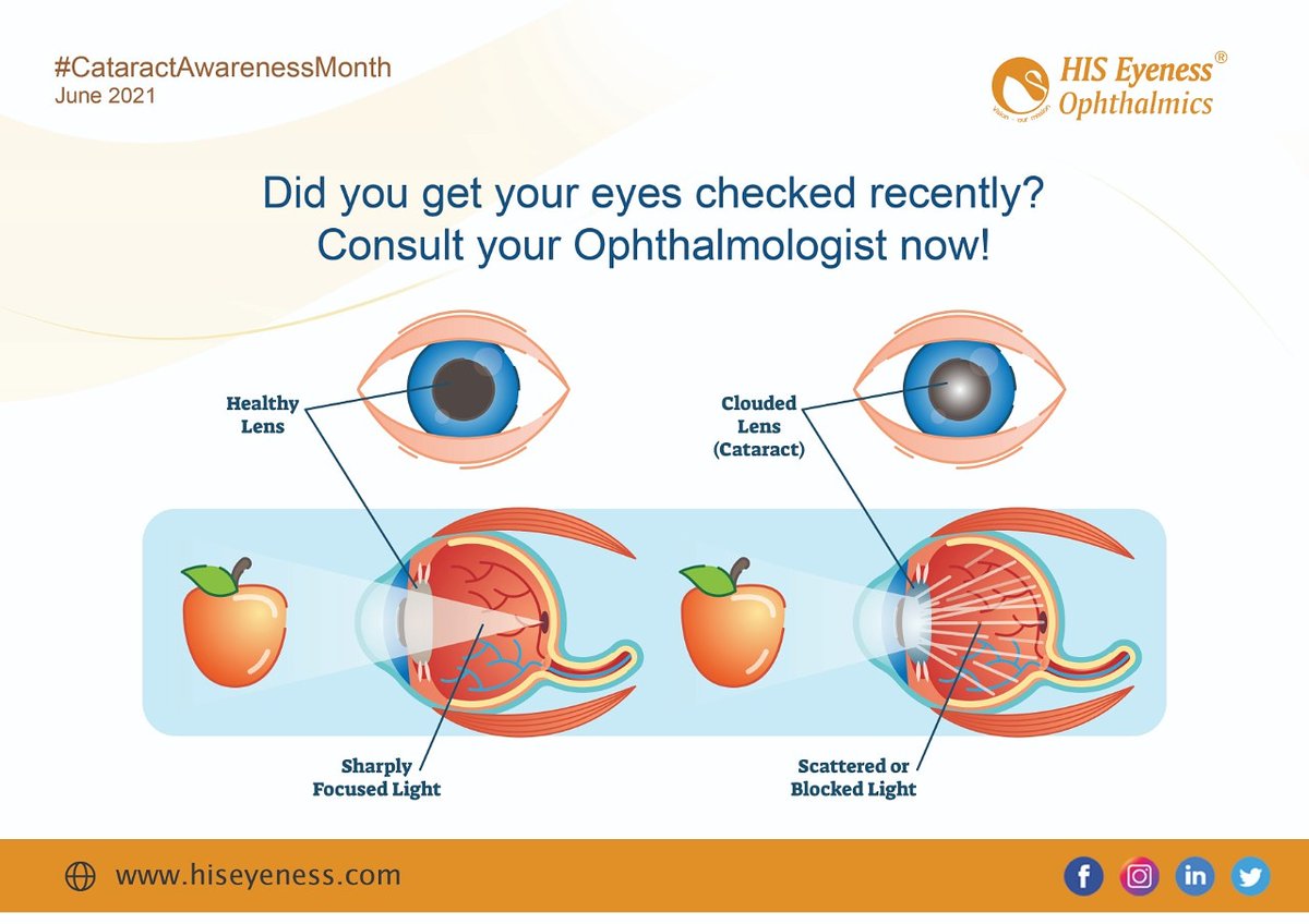 Hiseyeness_'s tweet photo. To see again is to live again
#actandprotect
#Cataractawarenessmonth
#visionislife #consultyourophthalmologist
#weareyeprotection #protectyoureyes #eyesforlives
#hiseyenesscares #hiseyeness #hiseyenessophthalmics #eyecare #visioncare #contactlenses #eyesight #healthyvision https://t.co/Mbh7FSSk0R