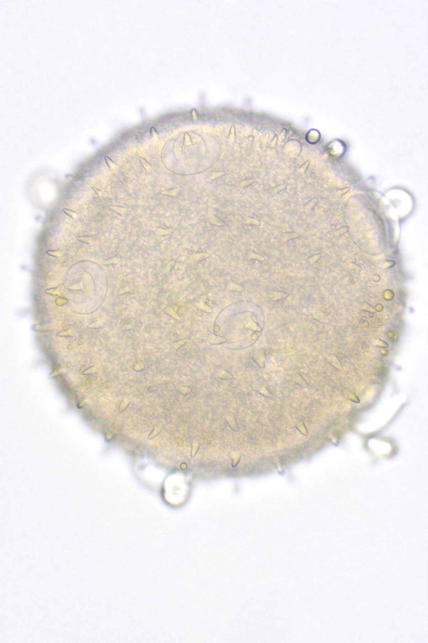 ちむら Twitterissa Rt Masamun75 カボチャの花粉を透過光で拡大しました トゲだけでなく 発芽孔や蓋がいくつか見られます 右上写真で2個ある蓋のうち右下にある蓋が 右下写真では外れかかっています カボチャ 花粉 発芽孔 T Co Zfuz1phnre