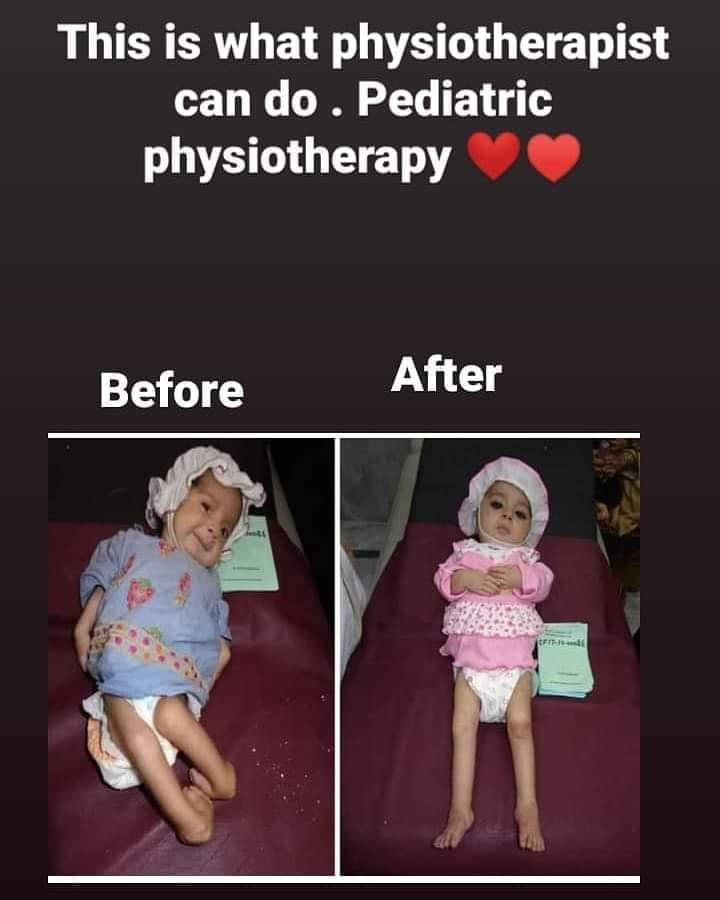 Claviclesa's tweet photo. ⠀⠀⠀⠀⠀⠀⠀⠀⠀⠀⠀⠀⠀⠀

هذا ما يستطيع العلاج الطبيعي فعله من أجل طفلك ❤

⠀⠀⠀⠀ https://t.co/8mr3SV5tlV