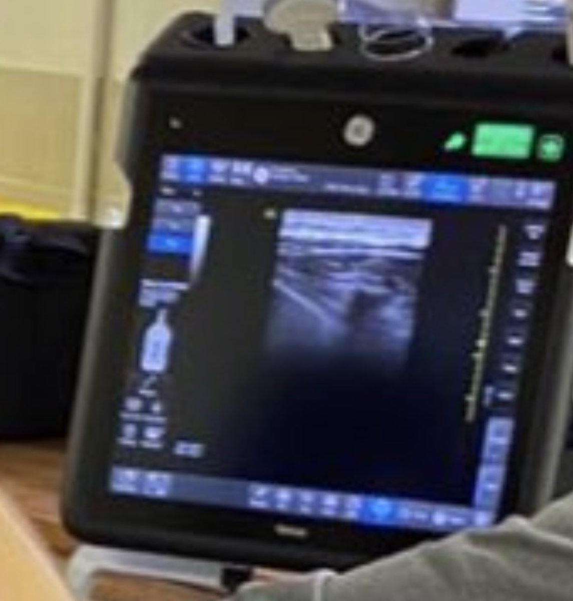 amit_pawa's tweet photo. I am loving the image on that @GEHealthcare #VenueFamily #GEvenue !
#Paravertebral https://t.co/s3ok8P8tSV