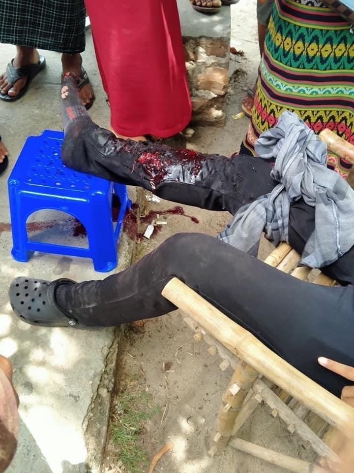 IrrawaddyNews's tweet photo. A man was injured and a number of motorbikes were damaged in a bomb explosion outside the Road Transport Administration Department in Chanmyathazi Township, #Mandalay at around 11.30 a.m. on Friday. (Photo: CJ) 

#WhatsHappeningInMyanmar https://t.co/hMF7xT3f0R