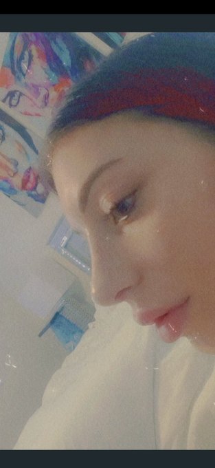 Getting a nosejob and going on birth control pills to make my boobs grow = 2 of the BEST decisions i<a href="/tag/beautiful"class="tags"><span>#beautiful</span></a><a href="/tag/happy"class="tags"><span>#happy</span></a><a href="/tag/rhinoplasty"class="tags"><span>#rhinoplasty</span></a>