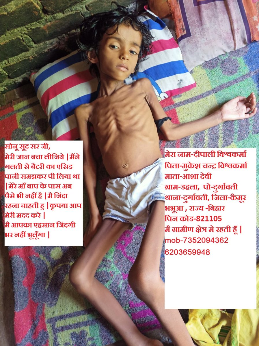 raju_educator's tweet photo. @SonuSood @SoodFoundation @HothurGivesBack @Ajaypratap777 @iamRJamit @Deoneinfrastru2 @rajutwites कृपया इस बच्ची की जान बचा लीजिए।मैं हाथ जोड़कर विनती करता हु। मैंने कई बार आपको ट्वीट किया है।pls pls https://t.co/Z6I4mCMe6j https://t.co/pjH2IAqyQM