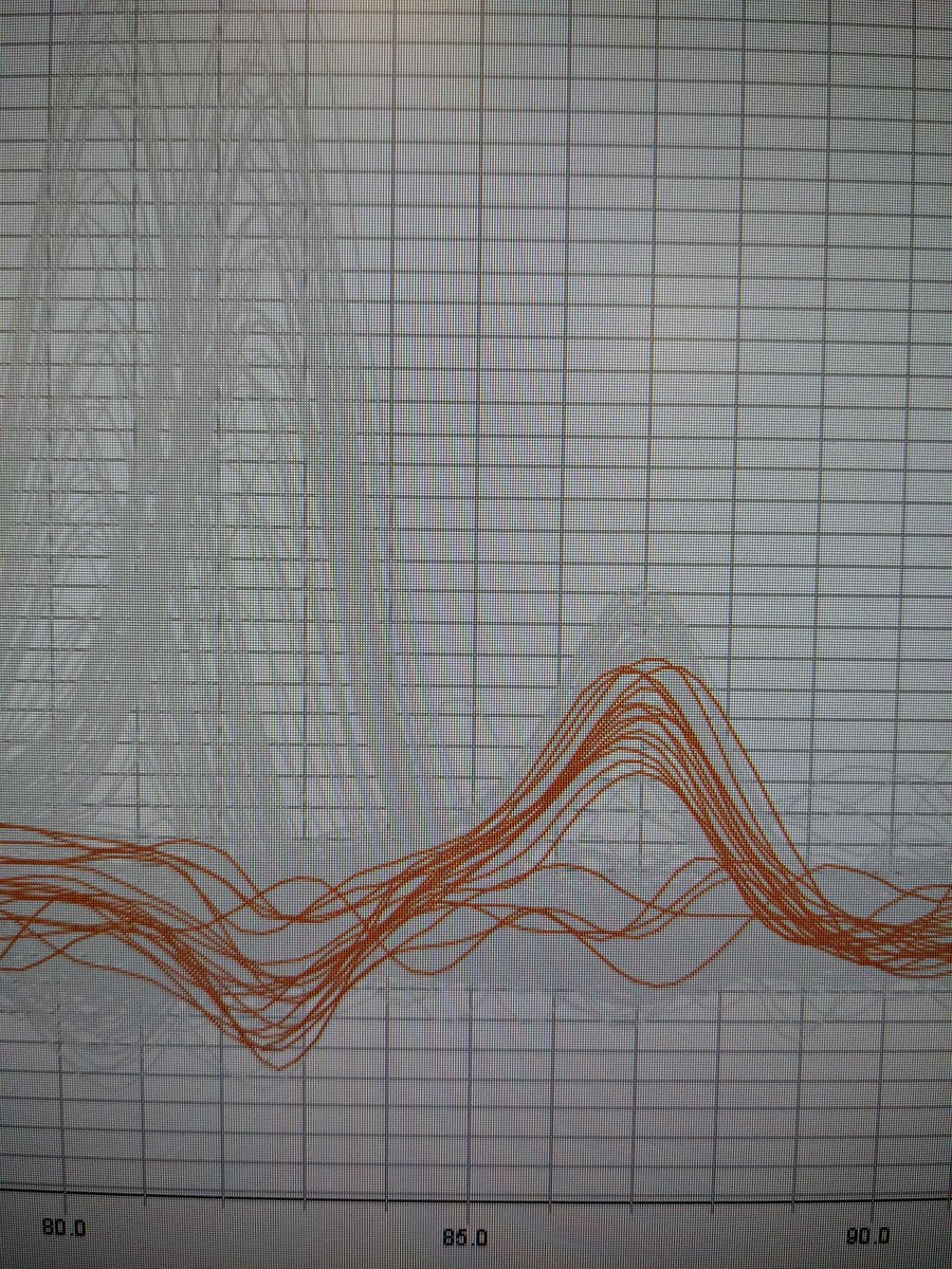 theresaemackey's tweet photo. qPCR friends- help needed! 

Have you ever seen melt curves with almost two inverse peaks? Something new I've come across and haven't found many resources... Thanks in advance! https://t.co/Xq7PeWxoRK