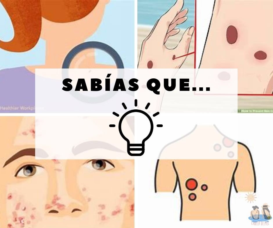 Cancerdepiel_'s tweet photo. ⚠️En México ocurren alrededor de mil casos anuales de cáncer de piel, la piel es susceptible de padecer enfermedades ocasionadas por la radiación solar. 🌞😱(Secretaría de Salud, 2015) #SabiasQue #cancerdepiel https://t.co/d48AFVbgce