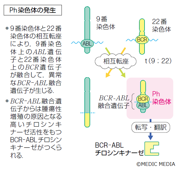 病気がみえる On Twitter Ph染色体 慢性骨髄性白血病 Cml は 9番染色体と22番染色体の相互転座 により生じるphiladelphia染色体 Ph染色体 が原因となって引き起こされる Ph染色体は成人の急性リンパ性白血病 All でも25 40 の症例に認められる 病みえ5p