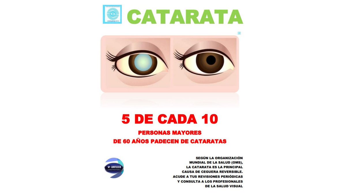 AMFECCO's tweet photo. 5 de cada 10 personas mayores de 60 años padecen de catarata. 
El 80% de la ceguera es prevenible o curable.
 Acude con un Lic. en Optometría. 
@COOPMOR   
https://t.co/PmigbGMgUT #cataratacongénita
 #catarata
 #cegueraprevenible 
#AMFECCO 
#saludvisual https://t.co/cwudhEyjCb