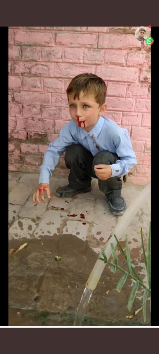 پنجاب میں بچوں کے ساتھ خونی کھیل کھیلا جارہا ہے مگر مجال ہےکہ کوئی نوٹس لے چھوٹے معصوم بچے گرمی کی وجہ سے خون میں لت پت ہورہے ہیں مگرکسی کو ان کی پرواہ نہیں ہے
ایسے حالات میں کومت فوری سکولوں کو بند کرنے کےاحکامات جاری کرے۔
#HEATWAVE 
<a href="/DrMuradPTI/">Dr. Murad PTI</a> <a href="/Shafqat_Mahmood/">Shafqat Mahmood</a> <a href="/GovtofPunjabPK/">Government of Punjab</a>