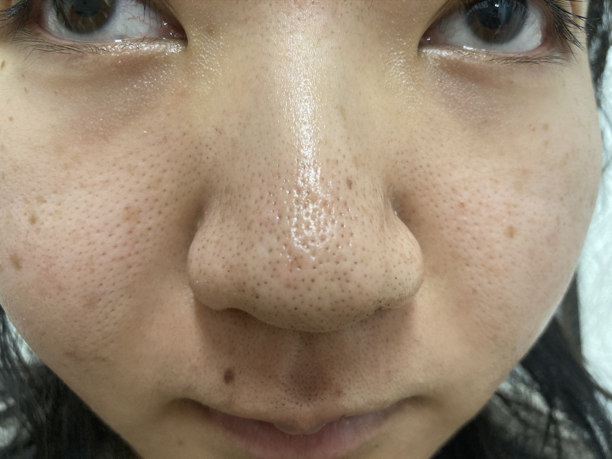 Twitter 上的 未来 よし 明日から野菜 お魚 海藻 きのこ 豆中心の食生活に挑戦します 私は汚肌が 一番のコンプレックスで Youtubeのコメントでも 肌汚いねって結構言われちゃうくらい 食生活でどれくらい変わるかわからないですが 頑張ります
