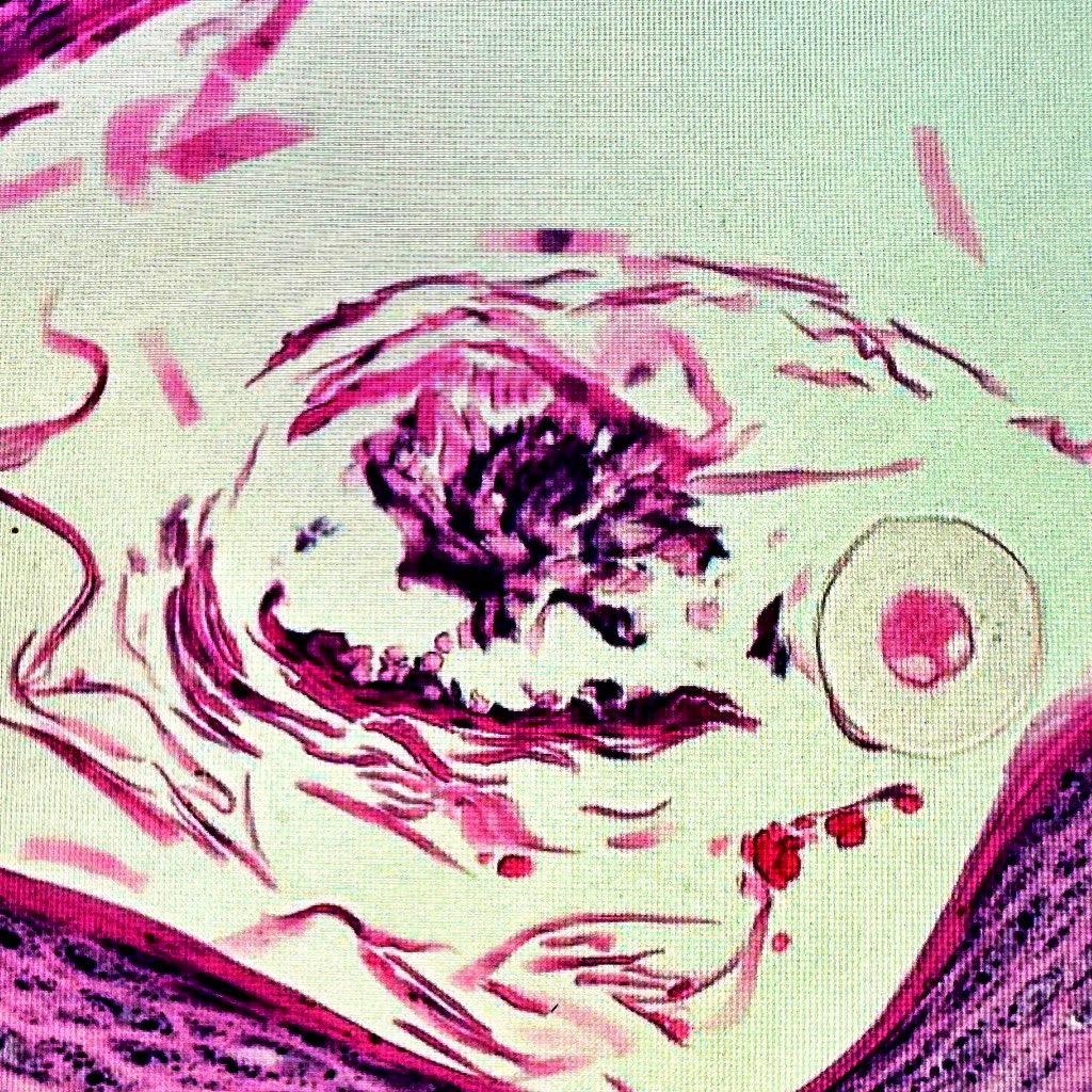 vetpathnerd's tweet image. A flower from a crusty dog... beauty in everything #vetpath #pathart