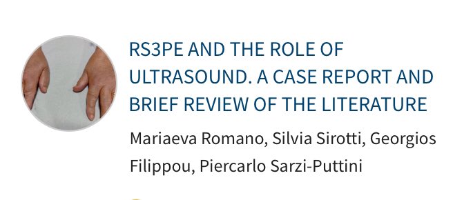 BeyondRheumatol's tweet photo. RS3PE and the role of ultrasound. A case report and brief review of the literature. https://t.co/9zWwnPkqcw
#Remitting seronegative symmetrical synovitis with pitting edema #RS3PE #ultrasonography #imaging https://t.co/K4ZmDSITWg