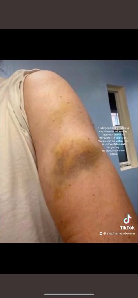 kaceface_'s tweet photo. @trishapaytas #justiceformoses #trishaforprison2021 https://t.co/yMh7QBl1rD