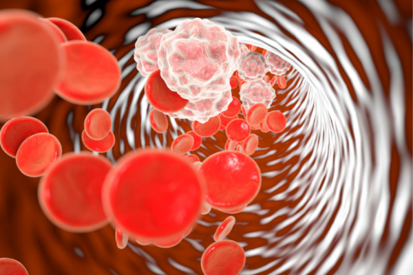 PHASEIV's tweet image. To Ice or Not to Ice? / Inflammation - Friend or Foe? - mailchi.mp/forsterphysica…