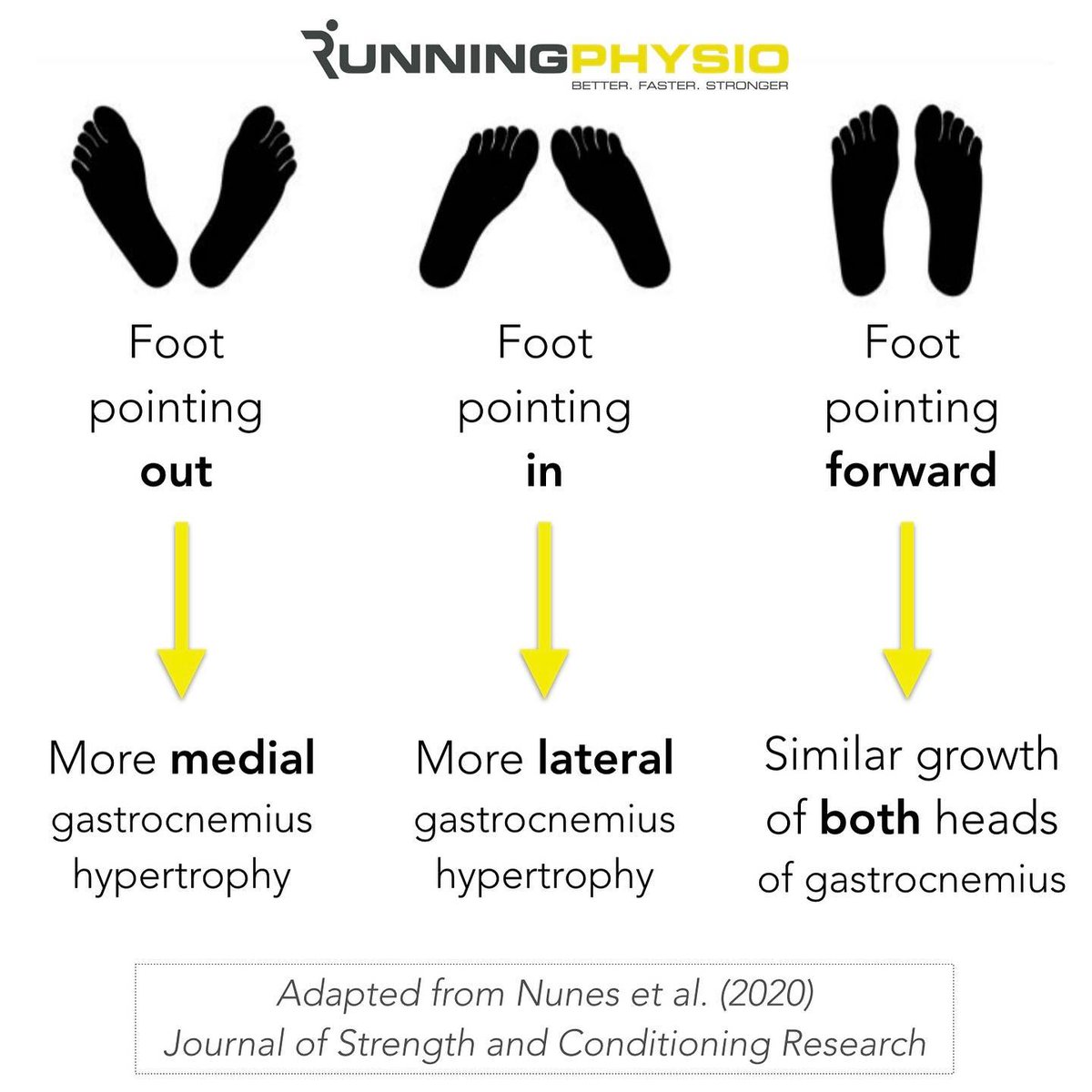 tomgoom's tweet photo. Foot position influences muscle hypertrophy during calf exercises. New research from Nunes et al. (2020) suggests to point the foot out to target medial gastroc and in to target lateral gastroc.
#calfworkout #calfexercises #calfmuscles #calfstrength https://t.co/m1iLfDa3Tp