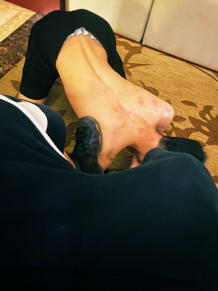chtdaht's tweet photo. 这狗，怎么踩几脚就红了？泡喷穿着味道真的感人，黑色袜子感觉更容易出味道🙄 https://t.co/KOnothu7S2