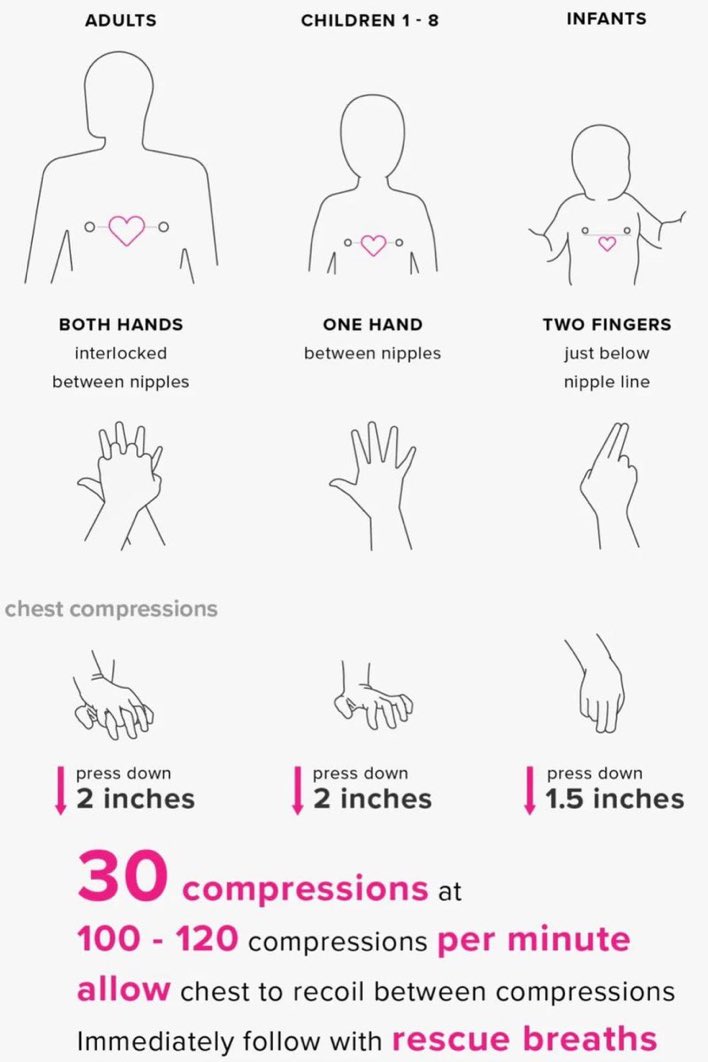 bornleader95's tweet photo. CPR should be made compulsory to teach in schools and institutions. You could save a life. 

Save it, learn it and remember it. 

#Eriksen https://t.co/Cys8VgsldX