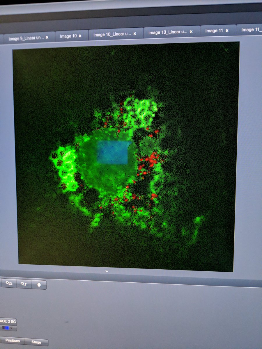 SimmondsLab's tweet photo. Achievement unlocked. Successfully imaged Cy3 and Alexa568 in same cell (plus 3 more fluorochromes) #lambascan #LSM700 https://t.co/gVSfQ0PtJH