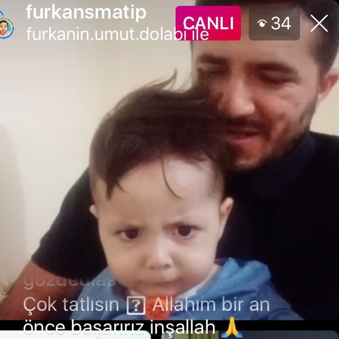 furkansmatip's tweet photo. Oğlum takipçilerinden 1 tuş ile onu kurtarmanızı istiyor. Oğlumu sinirlendirmeyin🤗🤗
Oğlum SMA hastası ile savaşıyor onu kurtarmak sizin elinizde.Çaresi varken oğlumu kaybetmek istemiyorum duyun bizi. Bakıp geçmeyin 🙏🏻

Recep Tayyip #deprem #sedatpeker10 #13Haziran #BabalarGünü https://t.co/abs1aqCQnE
