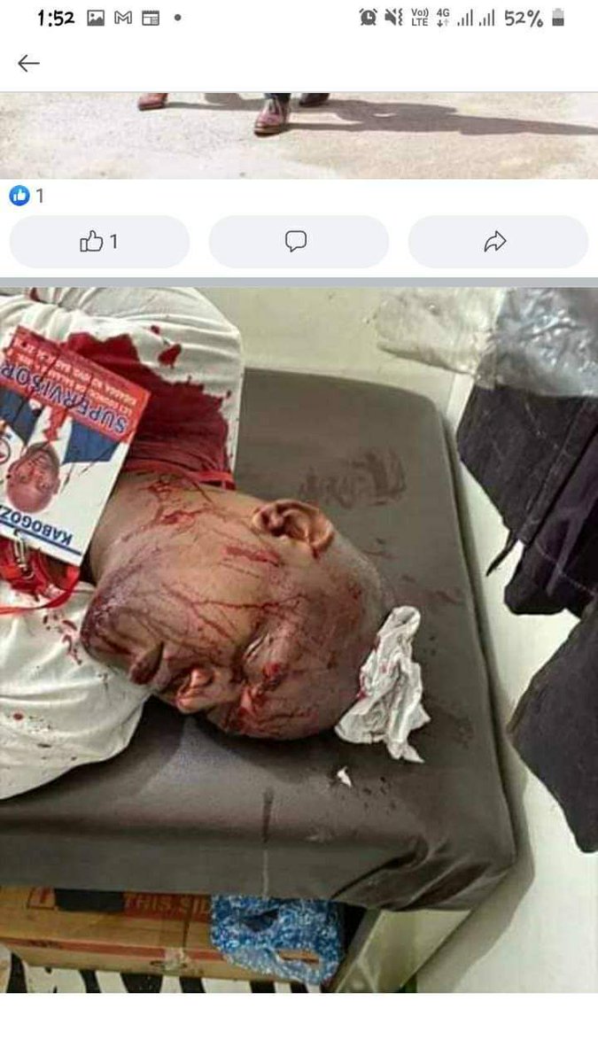munakyalo12's tweet photo. @NUP_Ug #UgandaIsBleeding 
#ArrestMuseveni https://t.co/s54X5YjLc4