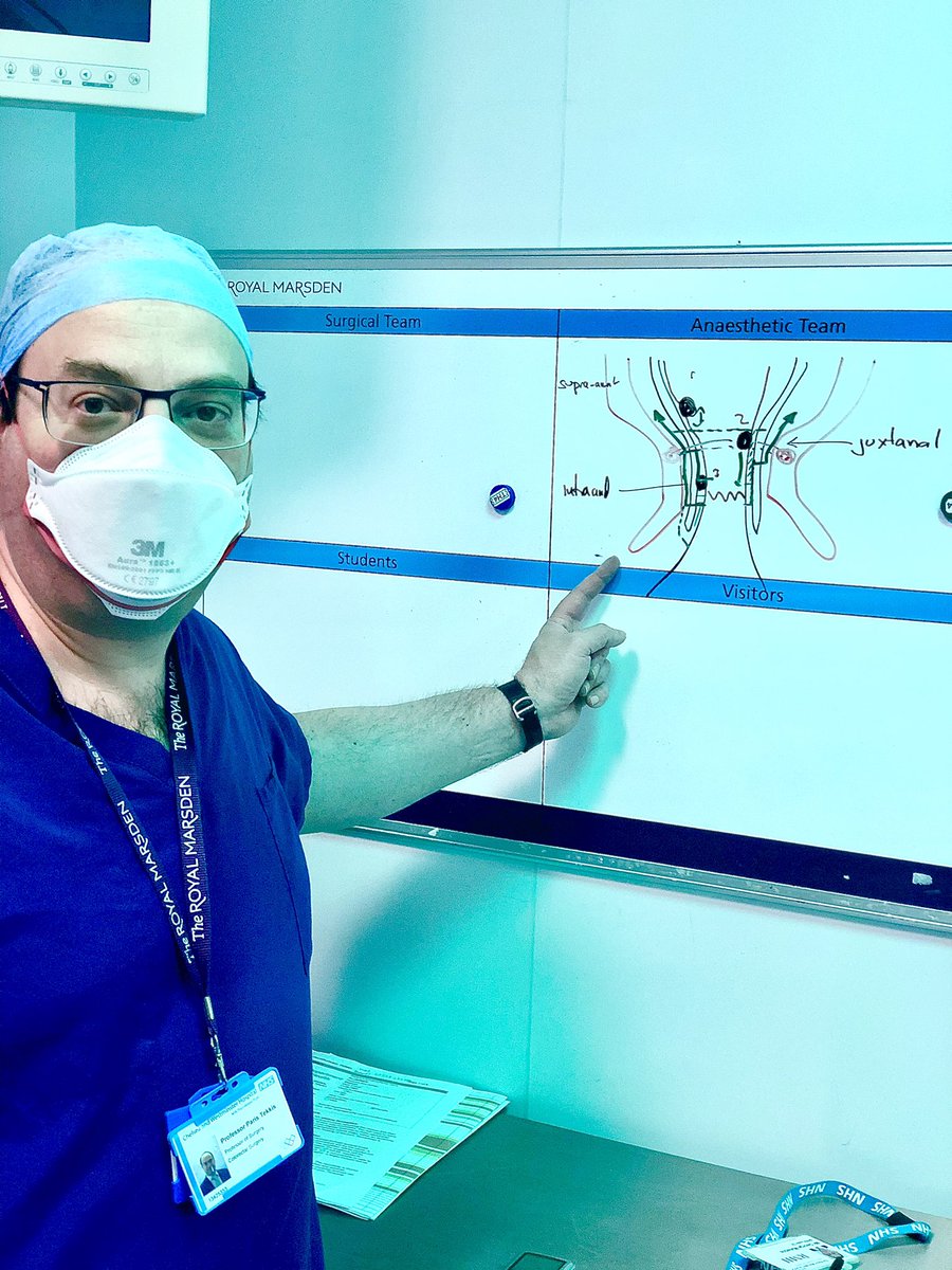 George Malietzis (@geomalietzis) on Twitter photo Throwback photo from my placement at <a href="/royalmarsdenNHS/">The Royal Marsden NHS Foundation Trust</a> Pull through and coloanal anastomosis;the ultimate challenge for a colorectal surgeon;3 ways of doing it and a diagram by <a href="/ParisTekkis/">Paris Tekkis</a> ;privileged to be taught and operate with him as challenge becomes motivation and success Throwback photo from my placement at <a href="/royalmarsdenNHS/">The Royal Marsden NHS Foundation Trust</a> Pull through and coloanal anastomosis;the ultimate challenge for a colorectal surgeon;3 ways of doing it and a diagram by <a href="/ParisTekkis/">Paris Tekkis</a> ;privileged to be taught and operate with him as challenge becomes motivation and success