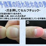 熱中症予備軍が分かる!爪を押して脱水症状を見分ける方法がこちら!