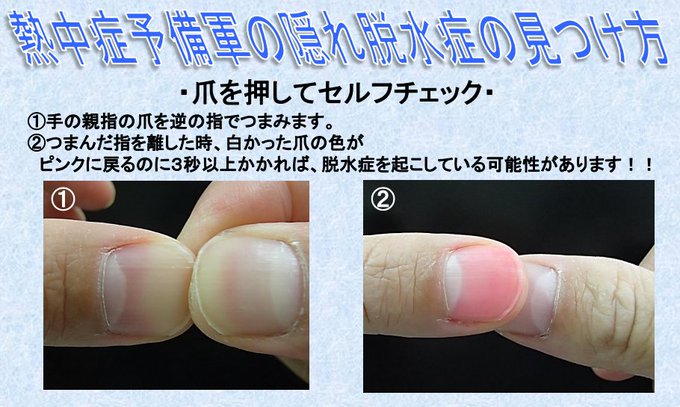 爪を押すだけでわかる 脱水症状 の見分け方が話題に ネット民 知らなかった いまトピ