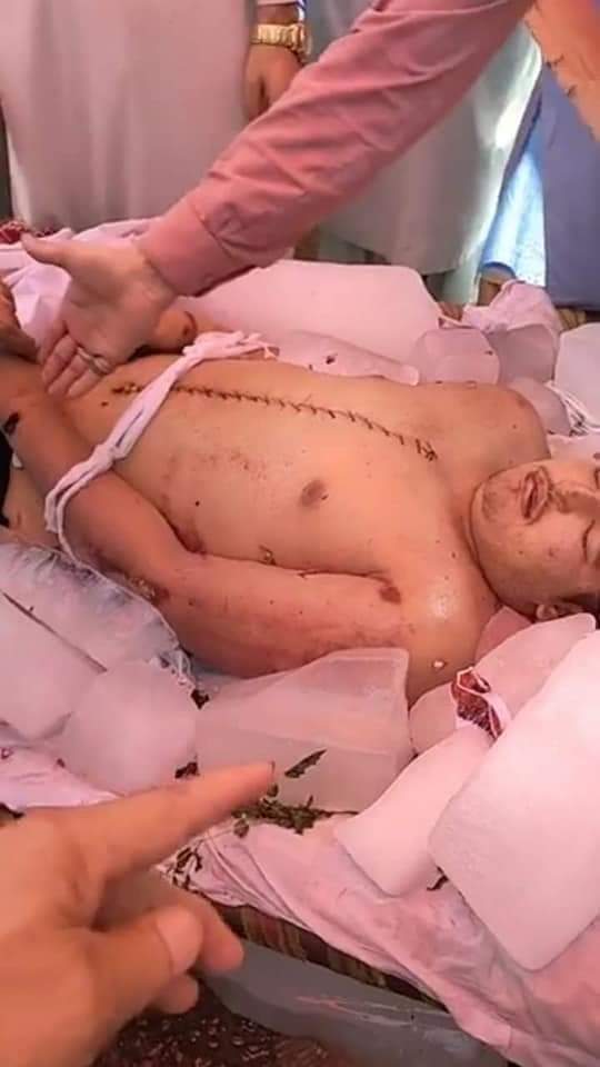 AsifIqbalReal's tweet photo. آج رات 8 بجے آپر دیر کے رہائشی حسن کو انصاف دلانے کے لئے ٹویٹر پر ٹرینڈ ہوگا۔ تمام دوستوں سے درخواست کی جاتی ہے کہ اس ٹرینڈ میں بڑھ چڑھ کر حصہ لیں۔۔۔ شکریہ 
ہیش ٹیگ: #JusticeForHassan https://t.co/RwX1LHbY0M