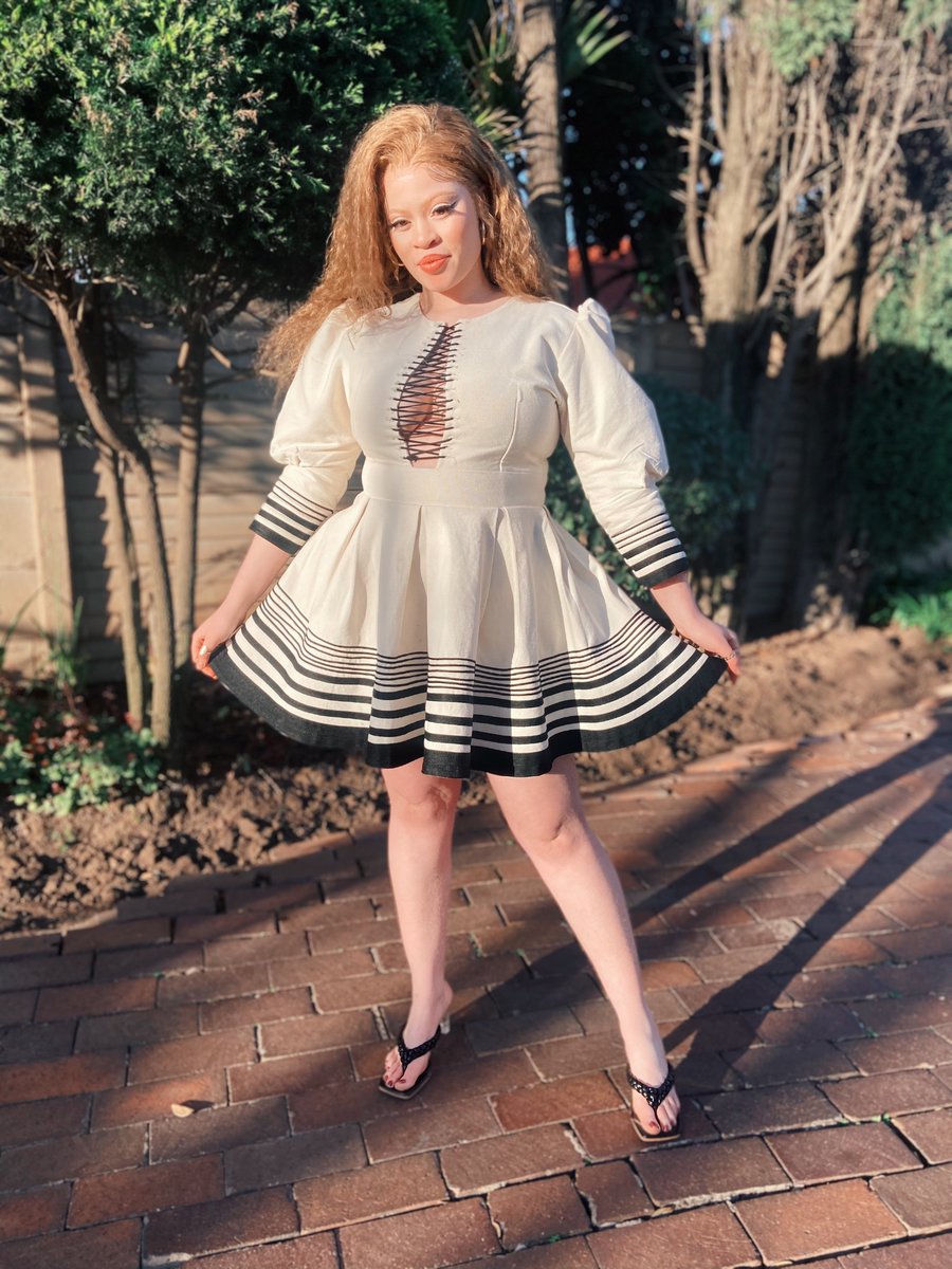 Snow_Thee's tweet image. #AlbinismAwarenessDay