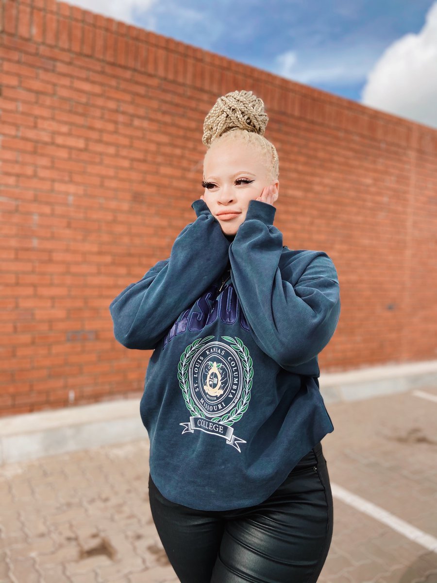 Snow_Thee's tweet image. #AlbinismAwarenessDay