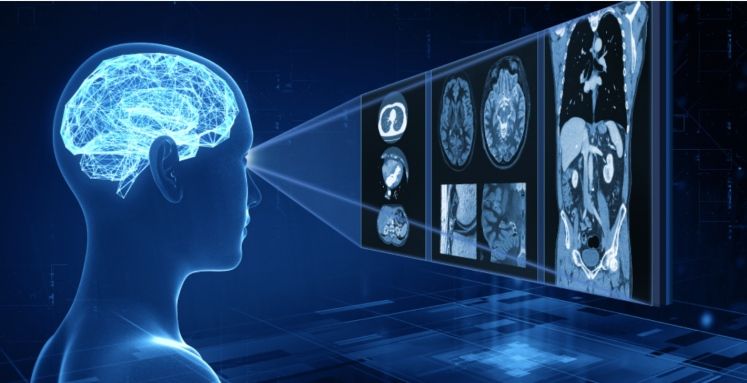 Cn1699's tweet image. Canon Medical’s Digital PET/CT System Receives FDA Clearance

#canonmedical #PETsystem #CT #FDAclearance 

For more information | ⬇️
buff.ly/3pRGNSS