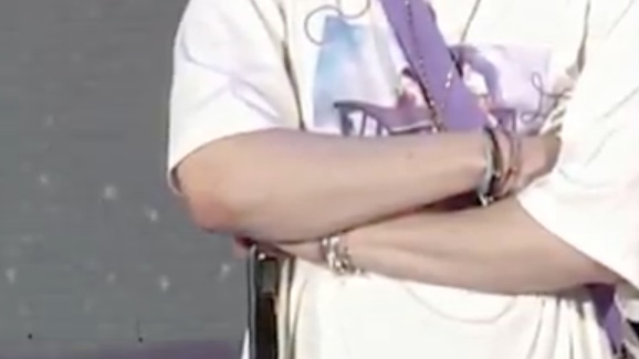 융기 팔꿈치핑꾸