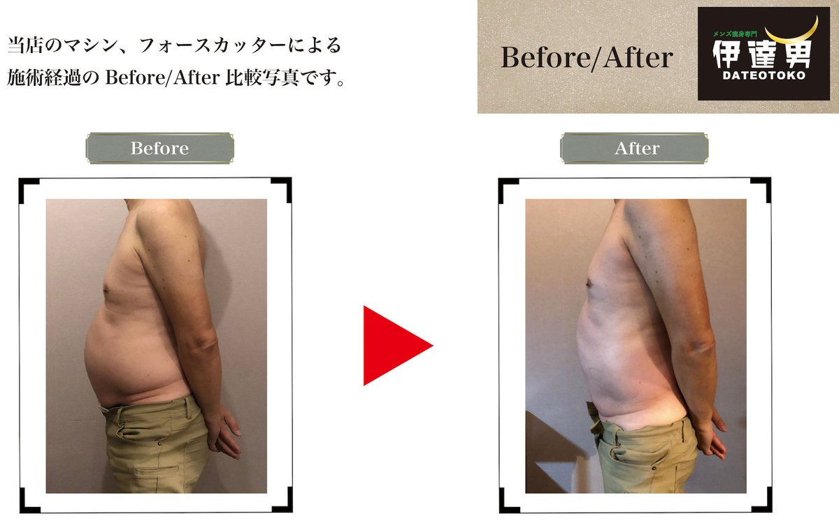 Men S 脱毛サロン 伊達男 ダテオトコ على تويتر こんにちは メンズ脱毛 痩身サロン伊達男です 最近 痩身ご希望のお客様が急増中です 夏直前 今なら間に合います T Co Ueec8pfvsl 仙台市 メンズ脱毛 メンズ痩身 伊達男 全身脱毛 Vio脱毛 ヒゲ Men S 脱毛サロン 伊達男 ダテオトコ على تويتر こんにちは メンズ脱毛 痩身サロン伊達男です 最近 痩身ご希望のお客様が急増中です 夏直前 今なら間に合います T Co Ueec8pfvsl 仙台市 メンズ脱毛 メンズ痩身 伊達男 全身脱毛 Vio脱毛 ヒゲ