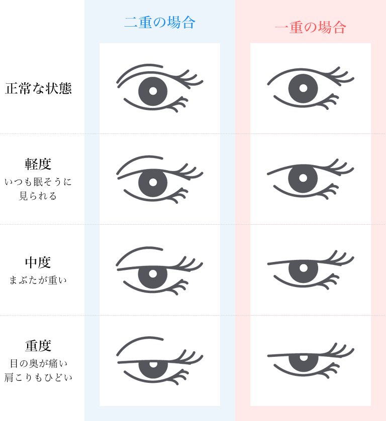 Mimi ベビーオイル洗顔の人 On Twitter あとは 無理矢理まぶたを引っ張ってコンタクトレンズを外したりするのも 眼瞼下垂の原因と言われてる 手を使わないでコンタクトを外すと言うアイテムも出てるから 外すのに苦労する人は使用推奨 というかこれ コロ助