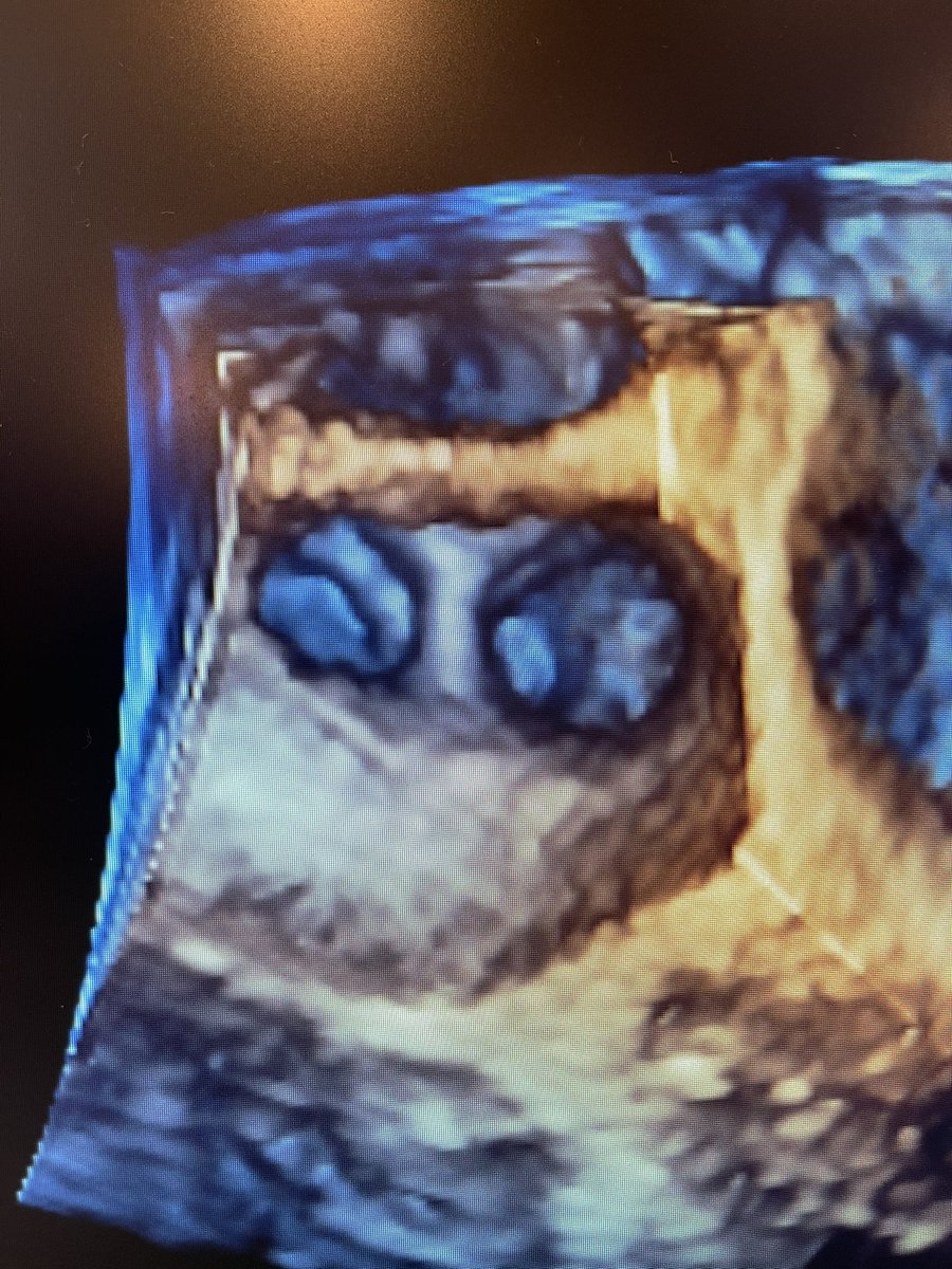 Darius Sholevar tweet media