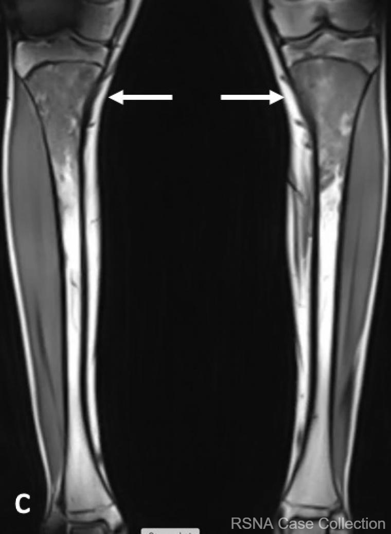 RSNACaseCollection_Editor tweet media