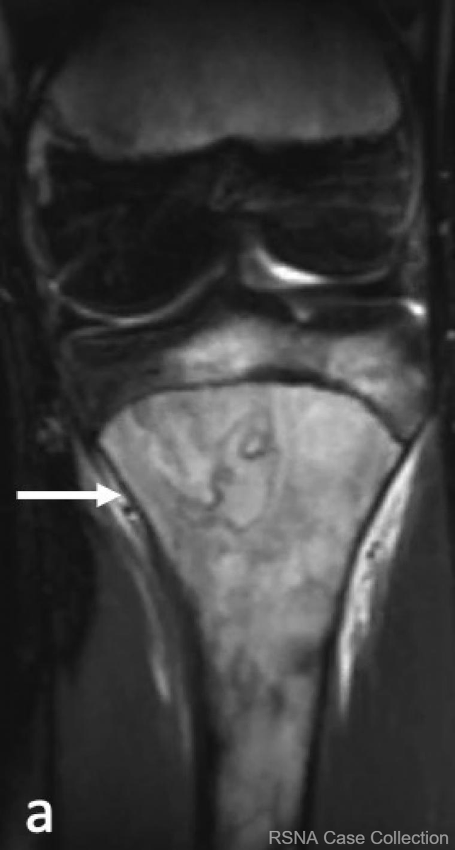 RSNACaseCollection_Editor tweet media