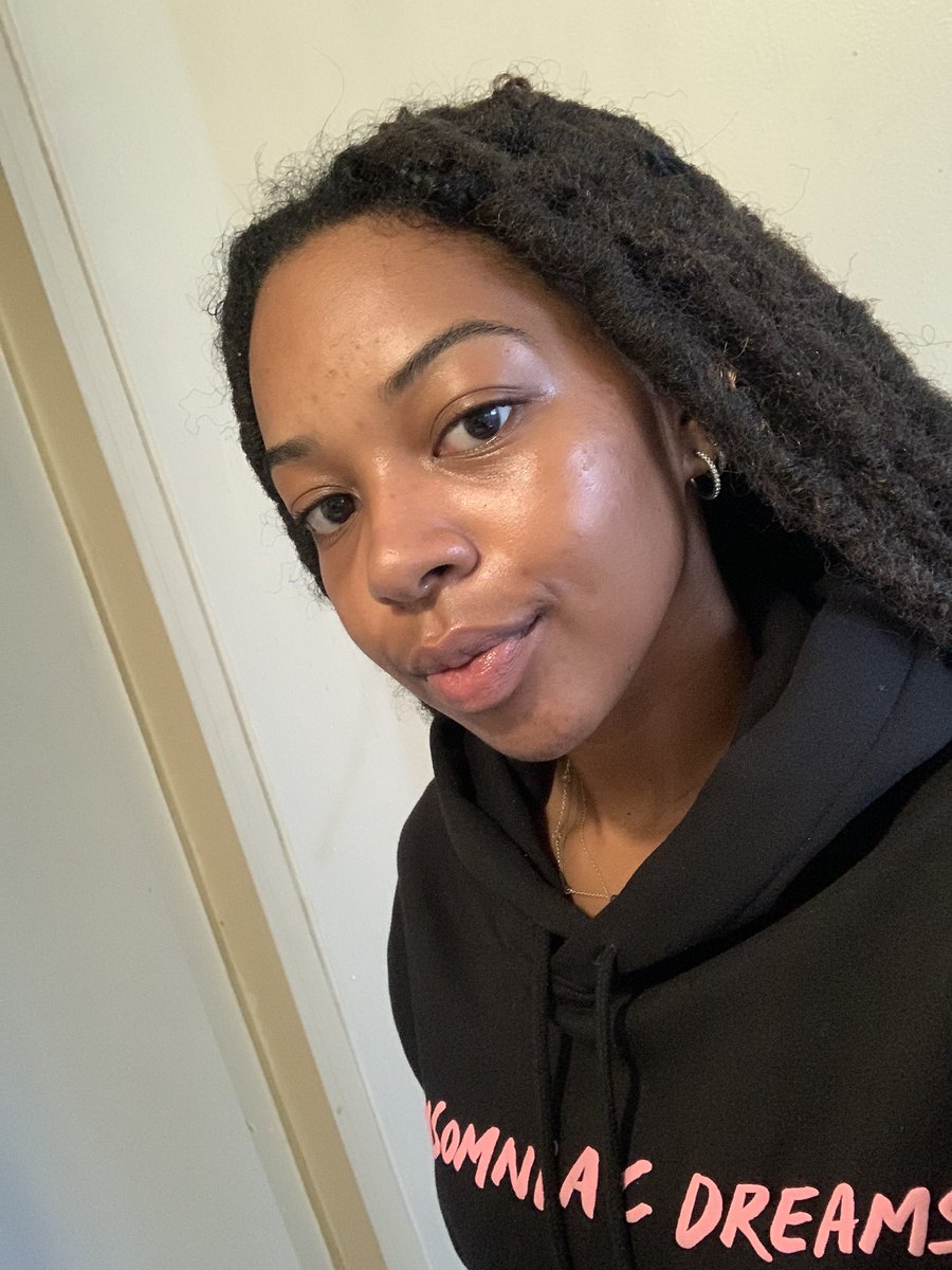 skin looking refreshed post peel 🥰 we’re in the clear, no new breakouts😩🤩 #acneawareness