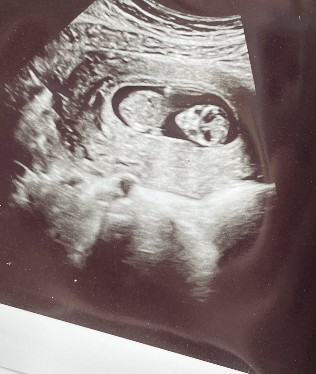 Taylor Winkel tweet media