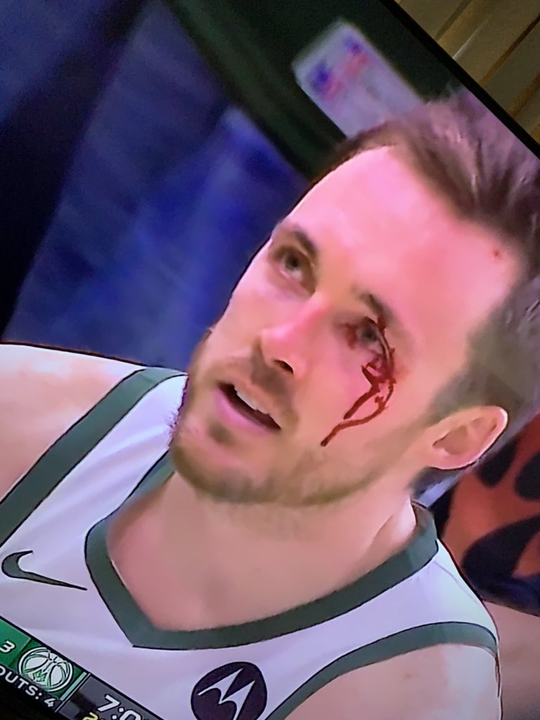 casualtakeking's tweet photo. “Bucks have refs on their side” 

With all due respect this was a no call btw https://t.co/uzp0LD80wb