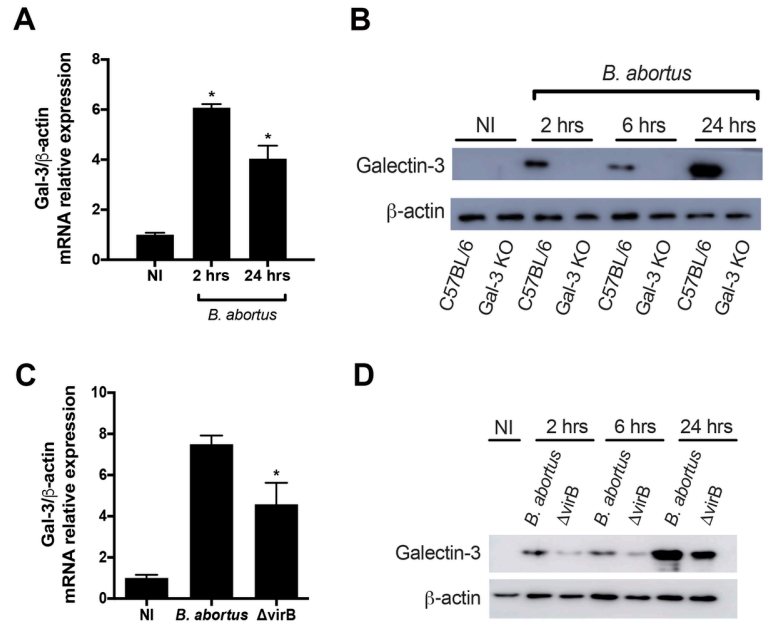Cellular Microbiology (@cellmicrobiol) on Twitter photo Check out the most recent paper in Cellular Microbiology by Tana et al. who look at the role of Galectin-3 in #Brucella #abortus infection and its effect on #cytokine production and bacterial replication #immunity #interferon #vacuole <a href="/ufmg/">UFMG</a>
Read it here: onlinelibrary.wiley.com/doi/abs/10.111… Check out the most recent paper in Cellular Microbiology by Tana et al. who look at the role of Galectin-3 in #Brucella #abortus infection and its effect on #cytokine production and bacterial replication #immunity #interferon #vacuole <a href="/ufmg/">UFMG</a>
Read it here: onlinelibrary.wiley.com/doi/abs/10.111…
