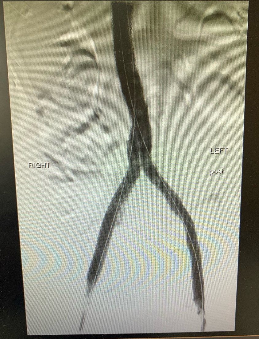 American Venous Forum | AVF tweet media