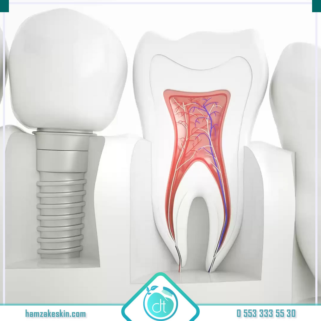 🎗 Dental implantlar kullanılarak yenilenen protez dişler doğal dişlerin bütün fonksiyonlarını yerine getirir. 
🎗Biz sizler için en güvenli ve kaliteli hizmeti vermek için dental implant markaları hakkında bilgileri sunuyoruz
🎗 Mode Dental İmplant 👉 bit.ly/3quipa2