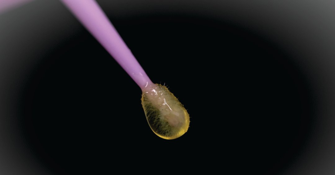 “A multi-step universal adhesive is a logic next evolution.” Read Dental Tribune’s interview with Prof. Bart Van Meerbeek and discover the recommendations of one of the most respected authorities on the topic of dental adhesives. #g2bonduniversal
fal.cn/3gp8Q