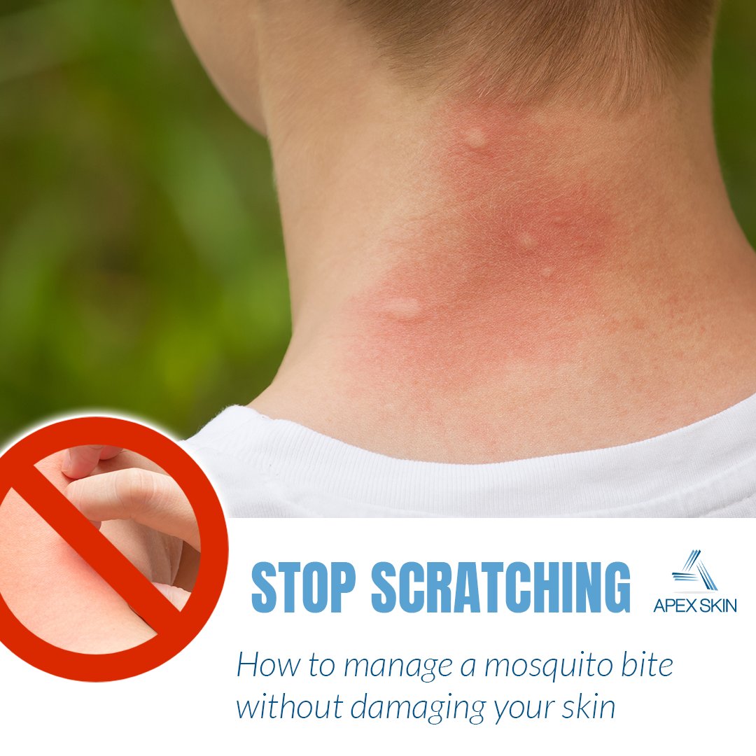 Apex Skin on Twitter "If you enjoyed the warm summer weather this