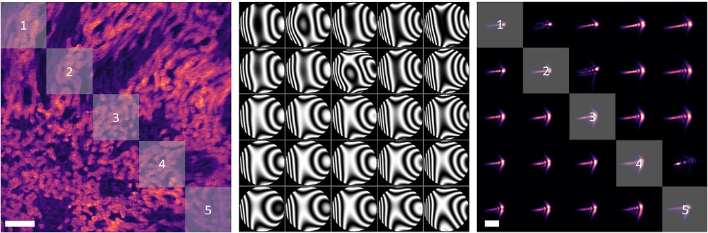 OpticaPubsGroup's tweet photo. An Editors' Pick via #OSA_OL: Spinning pupil aberration measurement for anisoplanatic deconvolution https://t.co/scib1QeeUv #ImageAcquisition #ImageReconstruction @polimi https://t.co/OIJiJfbYgm