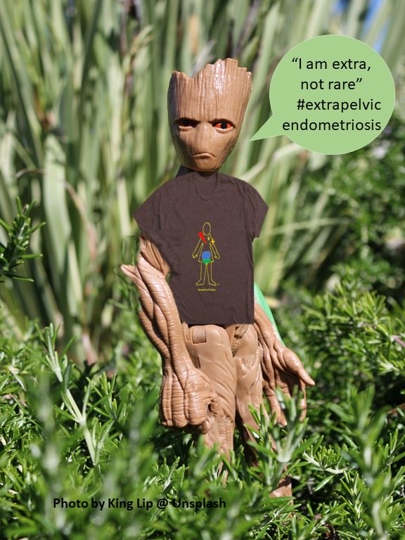 XtraNotRare's tweet image. If you didn’t get to order an #ExtrapelvicNotRare tee or hoody to support this unique #grassroots  #nonprofit closes Sunday July 7th.  #BeTheChange #ItTakesAVillage order @ bonfire.com/fundraising-pr… #ExtrapelvicEndometriosis #WeAreExtraNotRare