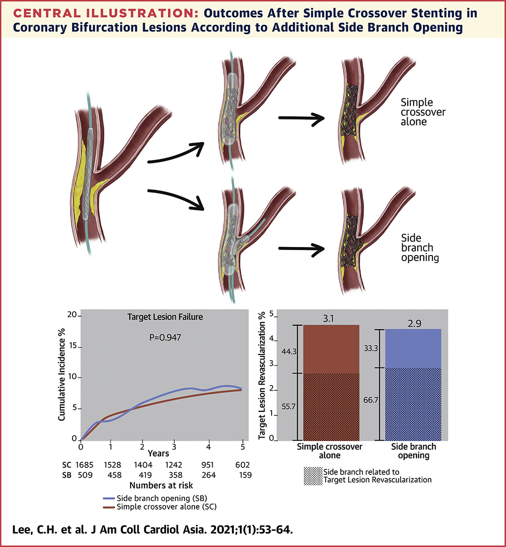 JACCJournals's tweet photo. Keep it simple in coronary #bifurcation? In provisional stenting of coronary bifurcations, 5-year outcomes after simple crossover stenting vs side-branch opening were similar. https://t.co/6QFfqTMlpd

#Korea #JACCAsia #ACCIntl #CardioTwitter #OpenAccess #cvMI https://t.co/8PFcwcwUrA